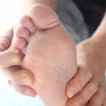 Surprising Causes Revealed: What Is Athlete's Foot Fungus Between the Toes and Where It Comes From